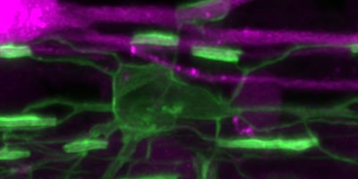 oligodendrocyte 