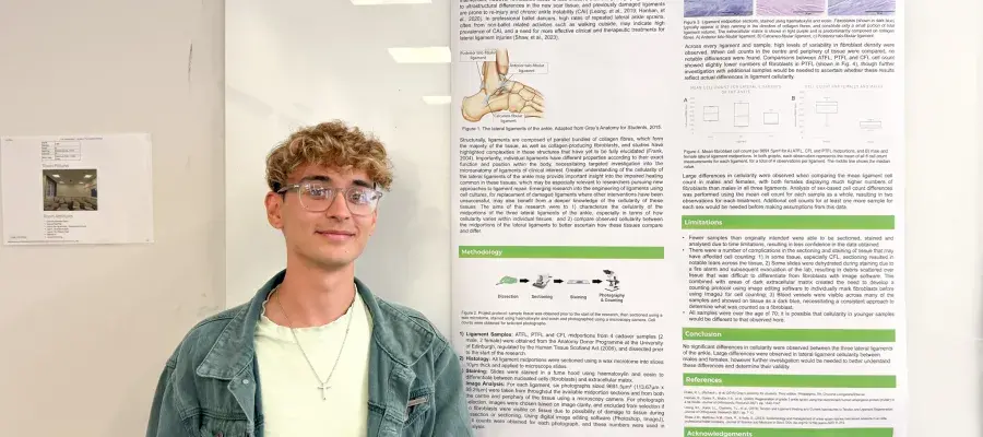 Declan Moran presents his summer research project