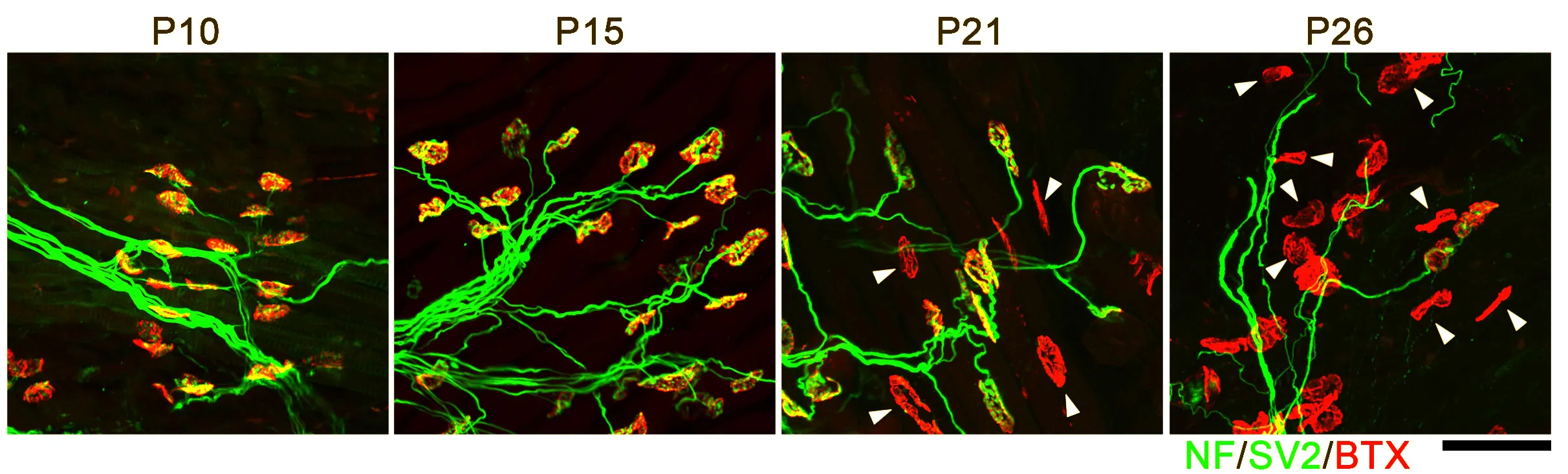 Synapses and axons in young mice, Murray Lab