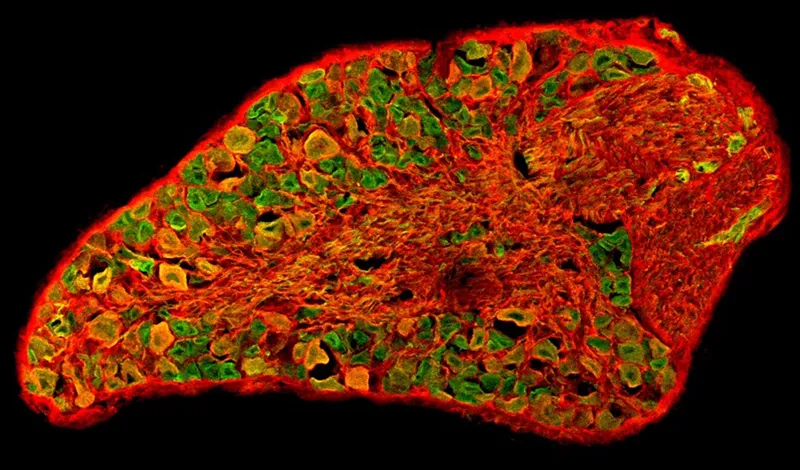 Immunohistochemically labelled dorsal root ganglion showing different populations of neurons