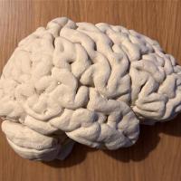 Plaster cast of right side of brain