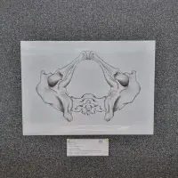 A drawing of the inferior view of a pelvis pinned to a poster board