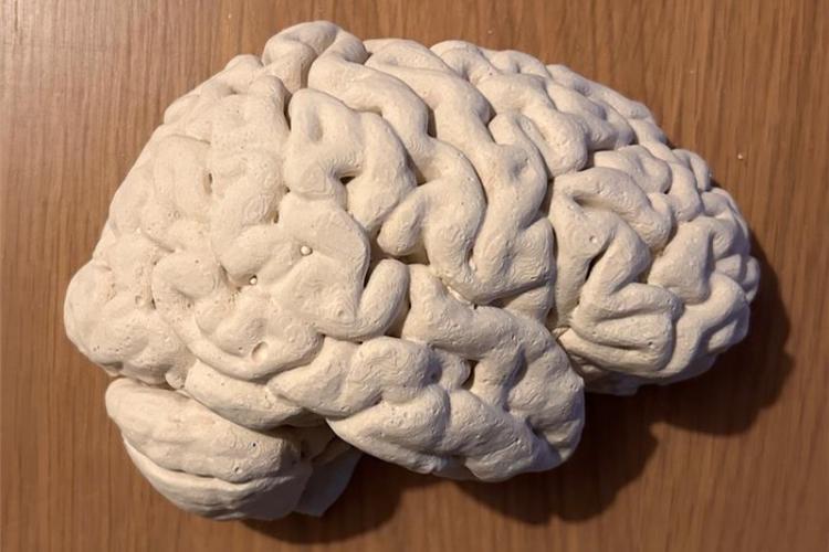 Plaster cast of right side of brain