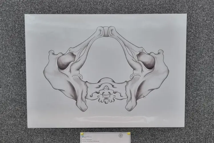 A drawing of the inferior view of a pelvis pinned to a poster board