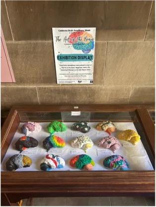 Painted Brain Models within Case 