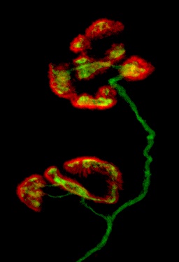 A confocal micrograph of a human neuromuscular junction. ​ ​