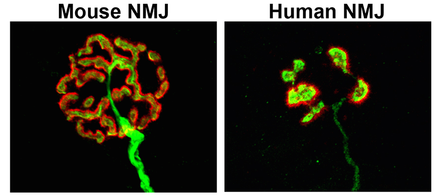 NMJ images for Press Release